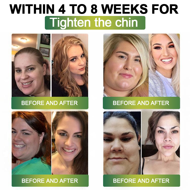 Clinically Proven|Official Store |Lenreey® NIDDK-Tirzepatide Slimming & health NANO MICRONEEDLE PATCH with Collagen & Matrixyl 3000丨Targets Obesity, Loose Skin, High Blood Pressure, Diabetes, Fatty Liver, Joint Pain, and More👩⚕️