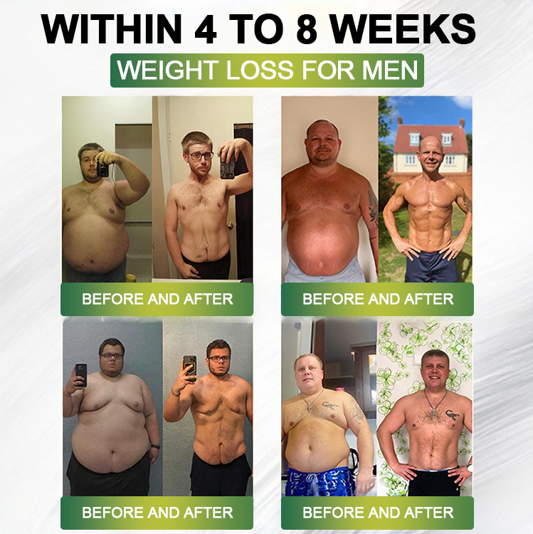 Clinically Proven|Official Store |Lenreey® NIDDK-Tirzepatide Slimming & health NANO MICRONEEDLE PATCH with Collagen & Matrixyl 3000丨Targets Obesity, Loose Skin, High Blood Pressure, Diabetes, Fatty Liver, Joint Pain, and More👩⚕️