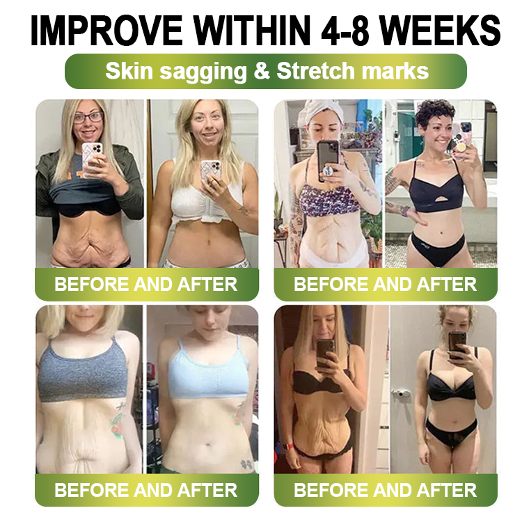 Clinically Proven|Official Store |Lenreey® NIDDK-Tirzepatide Slimming & health NANO MICRONEEDLE PATCH with Collagen & Matrixyl 3000丨Targets Obesity, Loose Skin, High Blood Pressure, Diabetes, Fatty Liver, Joint Pain, and More👩‍⚕️