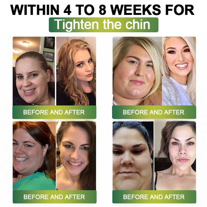 Clinically Proven|Official Store |Lenreey® NIDDK-Tirzepatide Slimming & health NANO MICRONEEDLE PATCH with Collagen & Matrixyl 3000丨Targets Obesity, Loose Skin, High Blood Pressure, Diabetes, Fatty Liver, Joint Pain, and More👩‍⚕️