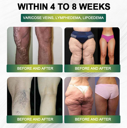 Clinically Proven|Official Store |Lenreey® NIDDK-Tirzepatide Slimming & health NANO MICRONEEDLE PATCH with Collagen & Matrixyl 3000丨Targets Obesity, Loose Skin, High Blood Pressure, Diabetes, Fatty Liver, Joint Pain, and More👩‍⚕️