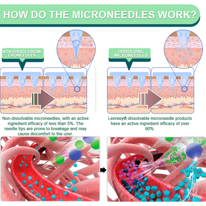 Clinically Proven|Official Store |Lenreey® NIDDK-Tirzepatide Slimming & health NANO MICRONEEDLE PATCH with Collagen & Matrixyl 3000丨Targets Obesity, Loose Skin, High Blood Pressure, Diabetes, Fatty Liver, Joint Pain, and More👩‍⚕️